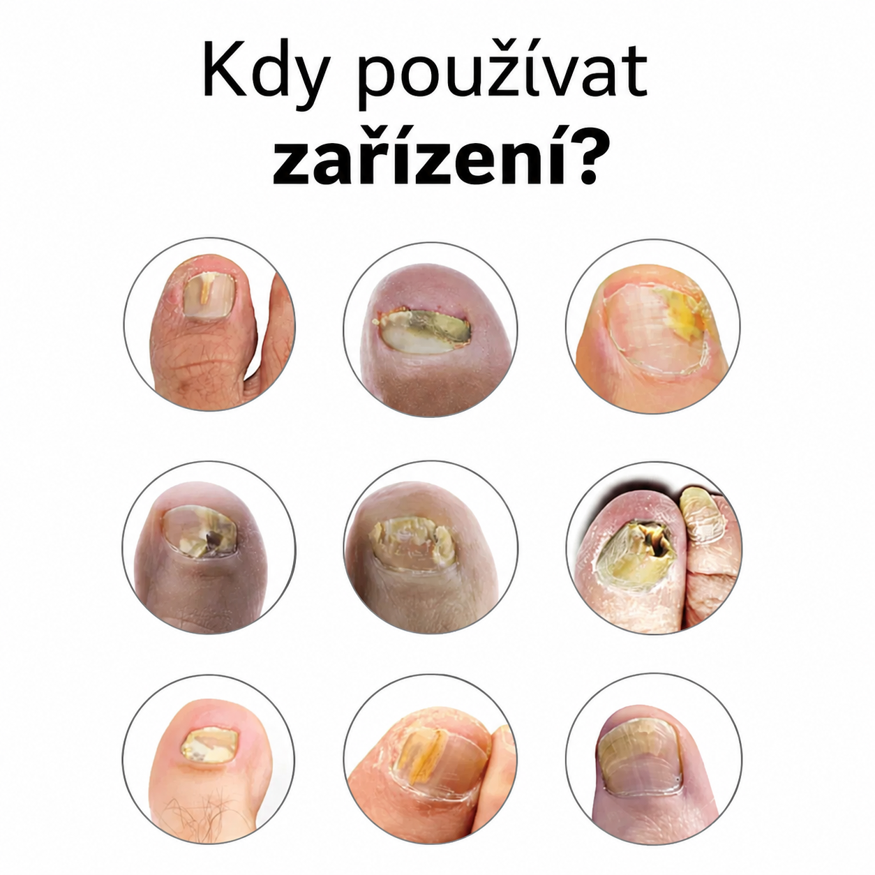Zařízení OrthoVital