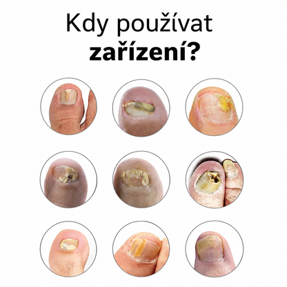 Zařízení OrthoVital